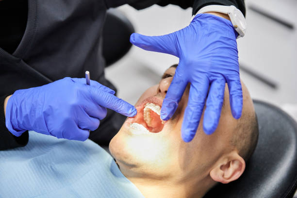 Best Teeth Whitening  in Troy, NY